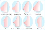 breast-shapes-new.webp