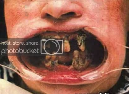 methmouth1.jpg