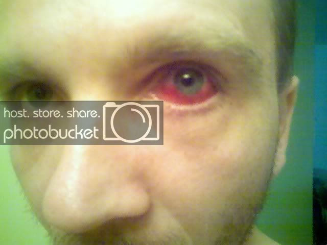 myfixedeye.jpg